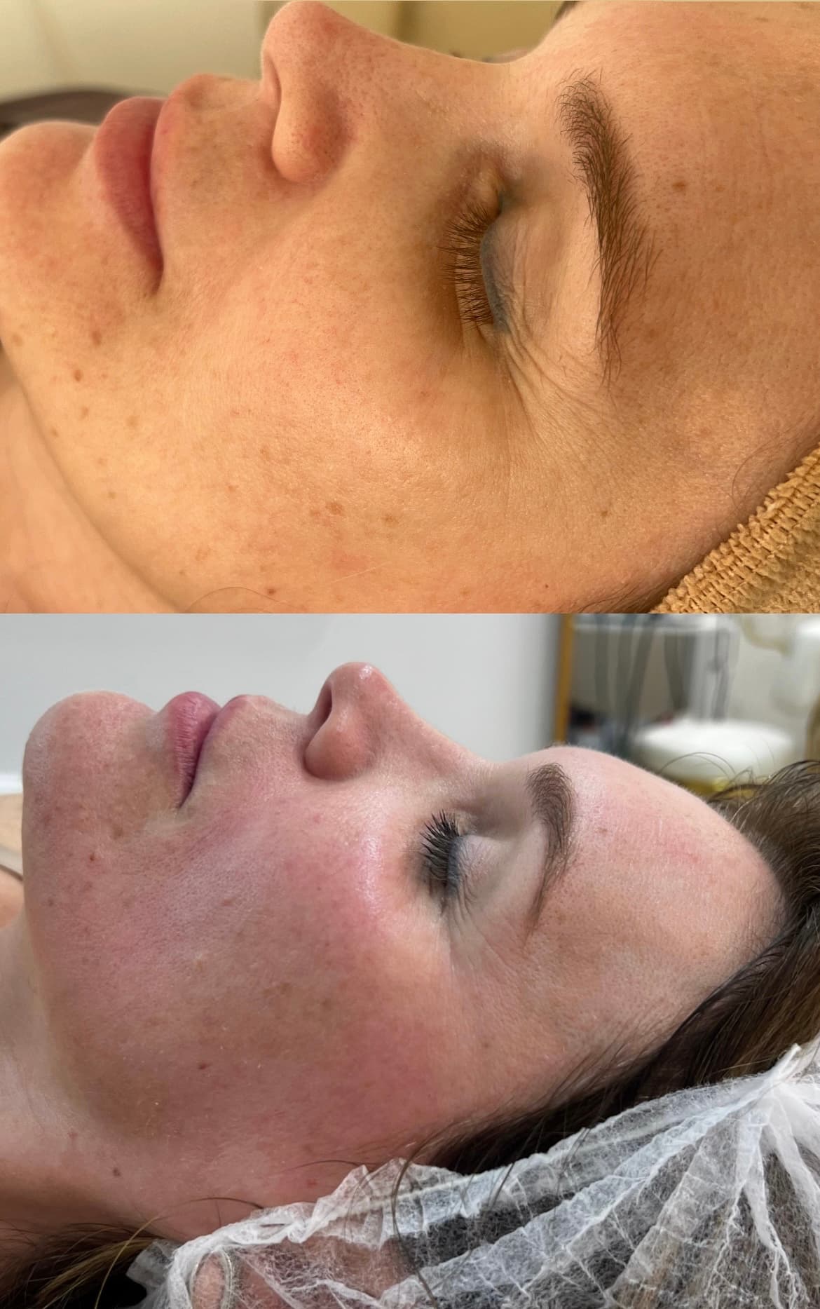 Resultado de protocolo facial