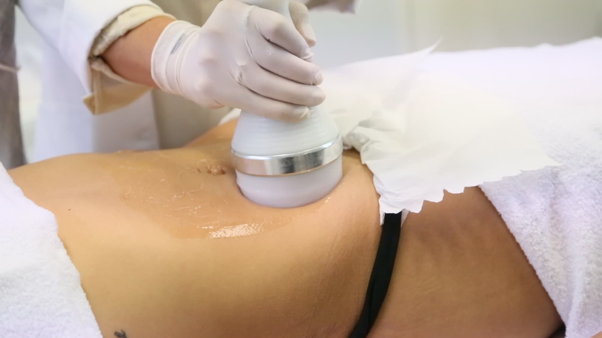 Aplicação de criofrequência na UnaEssential