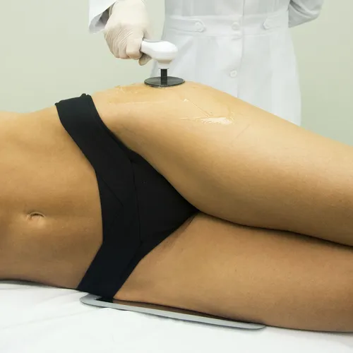 Aplicação da tecarterapia na UnaEssential