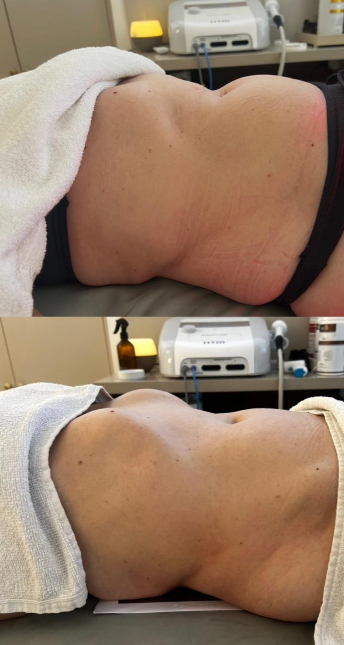 Sequência de fotos mostrando resultado de tratamento com melhora visível.