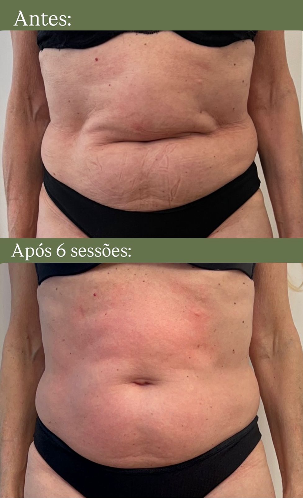 Foto de antes e depois evidenciando evolução de tratamento.